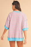 Oversized Striped Cuteness Top